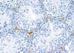 ATP5G1 Antibody in Immunohistochemistry (Paraffin) (IHC (P))