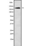 ABCA10 Antibody in Western Blot (WB)