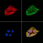 ABCA12 Antibody in Immunocytochemistry (ICC/IF)