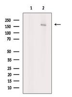 ABCA5 Antibody in Western Blot (WB)