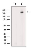 ABCA9 Antibody in Western Blot (WB)