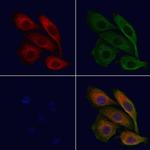 ABCC11 Antibody in Immunocytochemistry (ICC/IF)