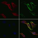 SUR1 Antibody in Immunocytochemistry (ICC/IF)