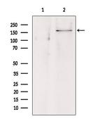 SUR1 Antibody in Western Blot (WB)