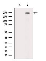 ABCC9 Antibody in Western Blot (WB)