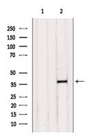 B4GALT7 Antibody in Western Blot (WB)