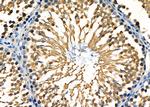 Bmp1 Antibody in Immunohistochemistry (Paraffin) (IHC (P))