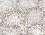 CAMLG Antibody in Immunohistochemistry (Paraffin) (IHC (P))