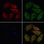 CABP4 Antibody in Immunocytochemistry (ICC/IF)