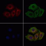 Calponin 3 Antibody in Immunocytochemistry (ICC/IF)