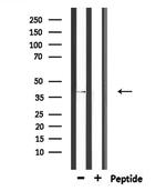 CHST11 Antibody in Western Blot (WB)