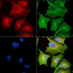 CHST5 Antibody in Immunocytochemistry (ICC/IF)