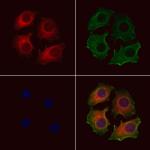 CHST14 Antibody in Immunocytochemistry (ICC/IF)