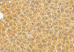 CHST14 Antibody in Immunohistochemistry (Paraffin) (IHC (P))