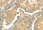 CHST14 Antibody in Immunohistochemistry (Paraffin) (IHC (P))