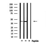 CHST14 Antibody in Western Blot (WB)