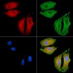 CATSPER1 Antibody in Immunocytochemistry (ICC/IF)