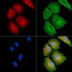 CATSPERB Antibody in Immunocytochemistry (ICC/IF)