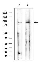 CATSPERB Antibody in Western Blot (WB)