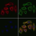 CHAC1 Antibody in Immunocytochemistry (ICC/IF)