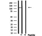 CCP110 Antibody in Western Blot (WB)