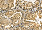 CCP110 Antibody in Immunohistochemistry (Paraffin) (IHC (P))