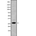 HAUS2 Antibody in Western Blot (WB)