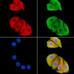 CEP63 Antibody in Immunocytochemistry (ICC/IF)