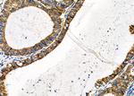 MCU Antibody in Immunohistochemistry (Paraffin) (IHC (P))