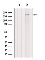 NCAPD3 Antibody in Western Blot (WB)