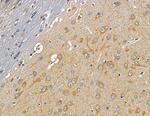 CNGB3 Antibody in Immunohistochemistry (Paraffin) (IHC (P))