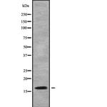 Cystatin F Antibody in Western Blot (WB)