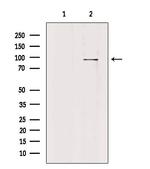 PLA2G4F Antibody in Western Blot (WB)