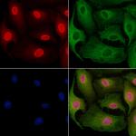 DHRS1 Antibody in Immunocytochemistry (ICC/IF)