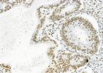 DHRS1 Antibody in Immunohistochemistry (Paraffin) (IHC (P))