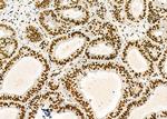 DHRS1 Antibody in Immunohistochemistry (Paraffin) (IHC (P))