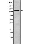 Desmoglein 4 Antibody in Western Blot (WB)