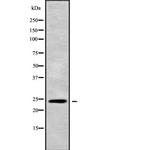 APOBEC3H Antibody in Western Blot (WB)