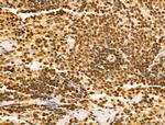 POLR1D Antibody in Immunohistochemistry (Paraffin) (IHC (P))