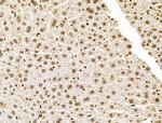 POLR1D Antibody in Immunohistochemistry (Paraffin) (IHC (P))