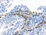 POLR1D Antibody in Immunohistochemistry (Paraffin) (IHC (P))