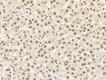 POLR1D Antibody in Immunohistochemistry (Paraffin) (IHC (P))