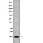 POLR1D Antibody in Western Blot (WB)