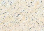 DYNLRB1 Antibody in Immunohistochemistry (Paraffin) (IHC (P))