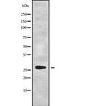 HSD17B8 Antibody in Western Blot (WB)