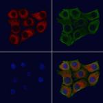 FOLR2 Antibody in Immunocytochemistry (ICC/IF)