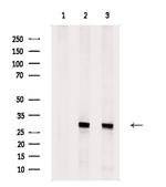 FOLR2 Antibody in Western Blot (WB)