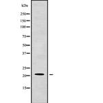 G-CSF Antibody in Western Blot (WB)