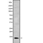 GUCA2B Antibody in Western Blot (WB)