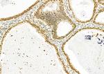 HEATR1 Antibody in Immunohistochemistry (Paraffin) (IHC (P))